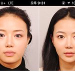 [드루와] <b>사각</b>턱이나 윤곽수술하고싶은사람들어와봐