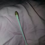 [강아지] 강아지 귀에서 나온 건데 <b>귀지</b>일까요ㅜㅜ?