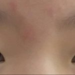 [조언부탁해] 나 성형할려는데 좀 봐줘 ㅜㅜ