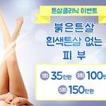 튼살<b>치료</b> 빨리 받으세요!