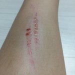 [댓글부탁해] (<b>약</b>혐) 얘들아 이거 흉 질까ㅠㅠㅠ? <b>사진</b>있엉