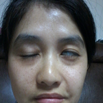 [쓰레기병원] <b>양악</b>수술후 자살기도한 사람입니다.