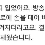 [BTOB] 창섭이 손 다쳤었대(재)ㅠㅠ