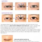 [드루와] <b>요새</b> 남자들이 많이 한다는 눈 성형.jpg