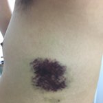 남친이 회사에서<b>상습</b>폭행을당했어요 사진첨부