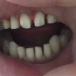 [쓰레기병원] 멀쩡한 앞니 강제로 갈아서 <b>xx</b>만들고 경찰까지 부른 악덕...