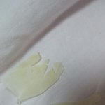 발바닥 <b>껍질</b>;;