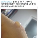 [EXO] ㅅㅂ <b>봉이</b>어떻게 녹냐고 지랄하면 보여줘라