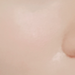 [드루와] 여드름피부 완전히 다 나은 법!!