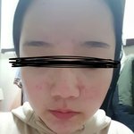 얘들아 나 <b>피부</b> 어떡해ㅠㅠ