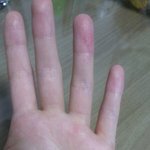 이거 손갑자기 <b>졸라</b>아픈데 뭐임?