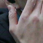 [방탄소년단] <b>아카</b> 손 왜이래..