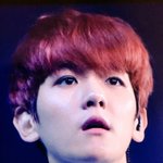 [EXO] 뜬금인데 변백 눈<b>다래끼</b> 붓기 아직도 안빠진거?