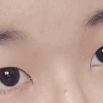 [댓글부탁해] 쌍꺼풀 수술을 해야할까..ㅠㅠㅠㅠ?