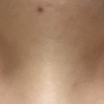 [댓글부탁해] <b>짝눈</b> 많이 심한거지?