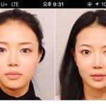 [댓글부탁해] 얼굴 돌려깎기 하면 이렇게 얼굴변한다