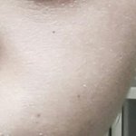 나 얼굴이 진짜 너무 건조해