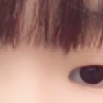 쌍수 해도 괜찮은 눈인가요?ㅠㅠ