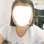 [조언부탁해] 볼살 빼는 방법 좀 조카 스트레스