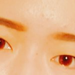<b>짝눈</b>은 어떡해 ㅠㅠ??