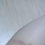 [19] 진짜 무릎에 <b>피멍</b>들은거 이상하게 봐?