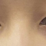 [댓글조언요] 고민)<b>쌍수</b>할까요 말까요??