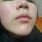 안면<b>홍조</b> 있는사람?