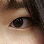 쌍수 ㅈㅂ 추반좀