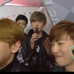 [EXO] 백현 턱 부작용.<b>JPG</b>