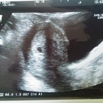 [꼭조언부탁] (7주로 수정)임신 3주...ㅠㅠ(+초음파사진)