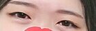얘들아 나는 쌍수해야되지?