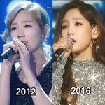 [드루와] 소녀시대 태연 <b>성형</b> 빼박 증거