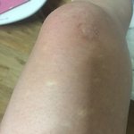 <b>청담</b> 미클리닉