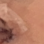남자인데 쌍수했는데 너무 부담스럽게 된거 같아요 평가좀 해주세요 <b>전후</b>
