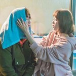 쌍수 붓기 걱정되는 친구드라