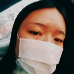 <b>이마</b> 여드름