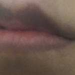 <b>입술색</b>이 보라색인데 어떻게 해야 돌아올까