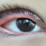 +혐주의 방금 쌍수했는데 이상해