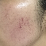[꼭조언부탁] 결혼3일전..피부관리받고 피멍, <b>원장</b>과 실장의 욕설..