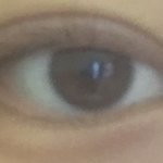 오늘<b>쌍수실밥</b>풀었다 ㅎㅎㅎ