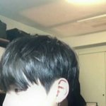 나 어금니 썩었나