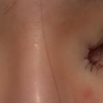 나 <b>방</b>굼 쌍수했어(사진 혐 <b>주의</b>)