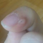 나 손가락에 이거 뭔지 알아ㅠㅠ?