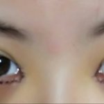<b>쌍수</b> 4일차인데 봐주라