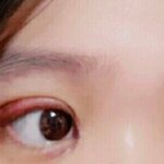 쌍수 눈 괜찮아?? (쌍수 <b>글</b> 올려서 <b>미안</b>해ㅠㅠ)