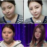 진짜 우리반애 저렇게 생긴애 한명 있는데 살빼면 <b>저리</b>돼?