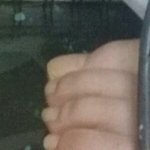 하..내발 조카 <b>족발</b>같이생겼다