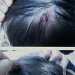 성산2동 <b>xx</b>아파트 어린이집 폭행사건추정