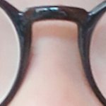 성형<b>견적</b>좀내주라