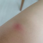 [드루와] 무릎 <b>아래</b>에 뭐 났는데 이거 뭔지 아는 사람...